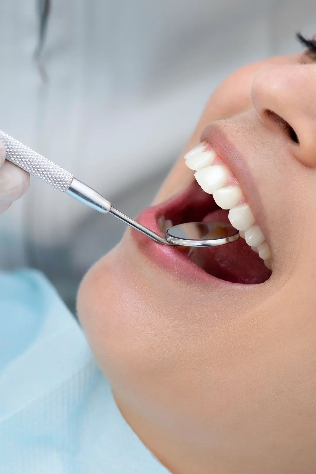 Checking restoration margins with a dental mirror, shown while covering Implant Procedures in Victoria