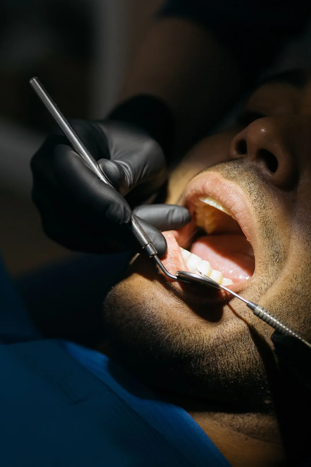 Close-up of a dental examination, referred to in the Dental Implants section for Victoria
