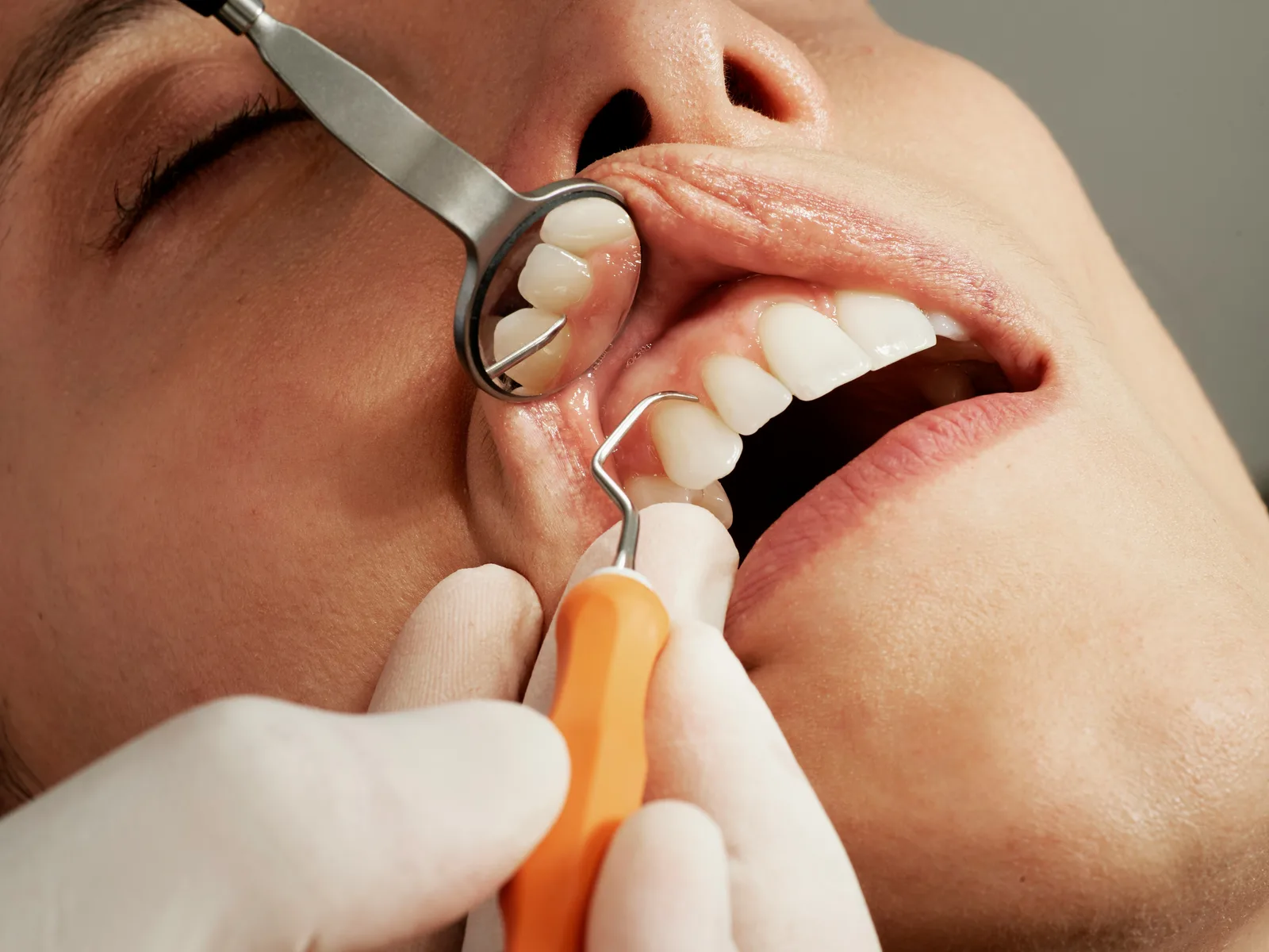 Dental examination with mirror and probe at a consultation in Victoria