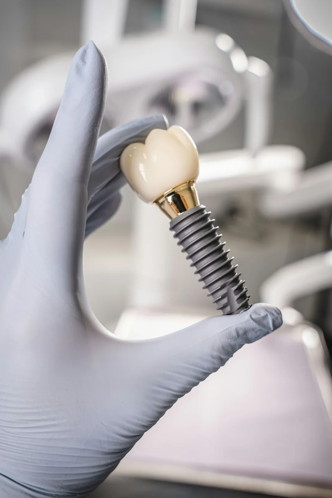 Dental implant fixture, abutment and crown, referred to in the dental implant treatment section for Victoria