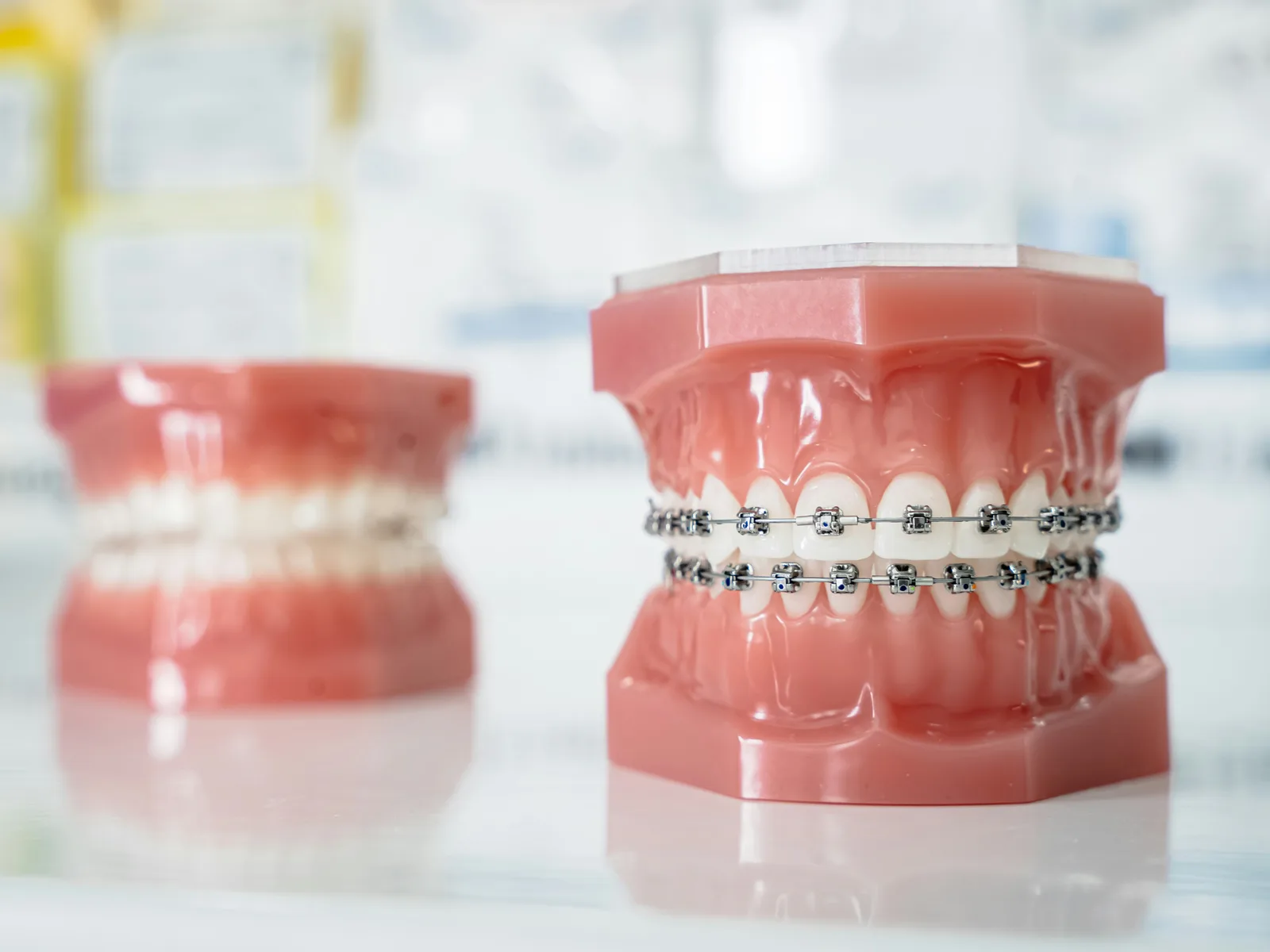 Dental study models at the practice, alongside the Same Day Implants explanation in Victoria