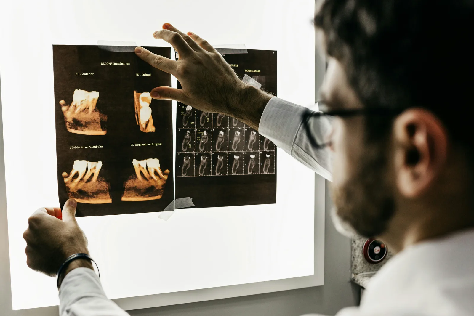 Dentist reviewing a CBCT scan before implant surgery, alongside the dental implant treatment explanation in Victoria