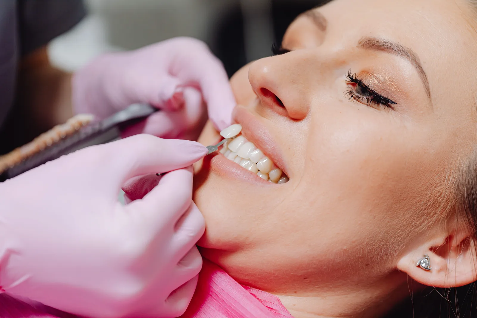 Checking gum health around the teeth, alongside the Tooth Extraction Implant explanation in Victoria