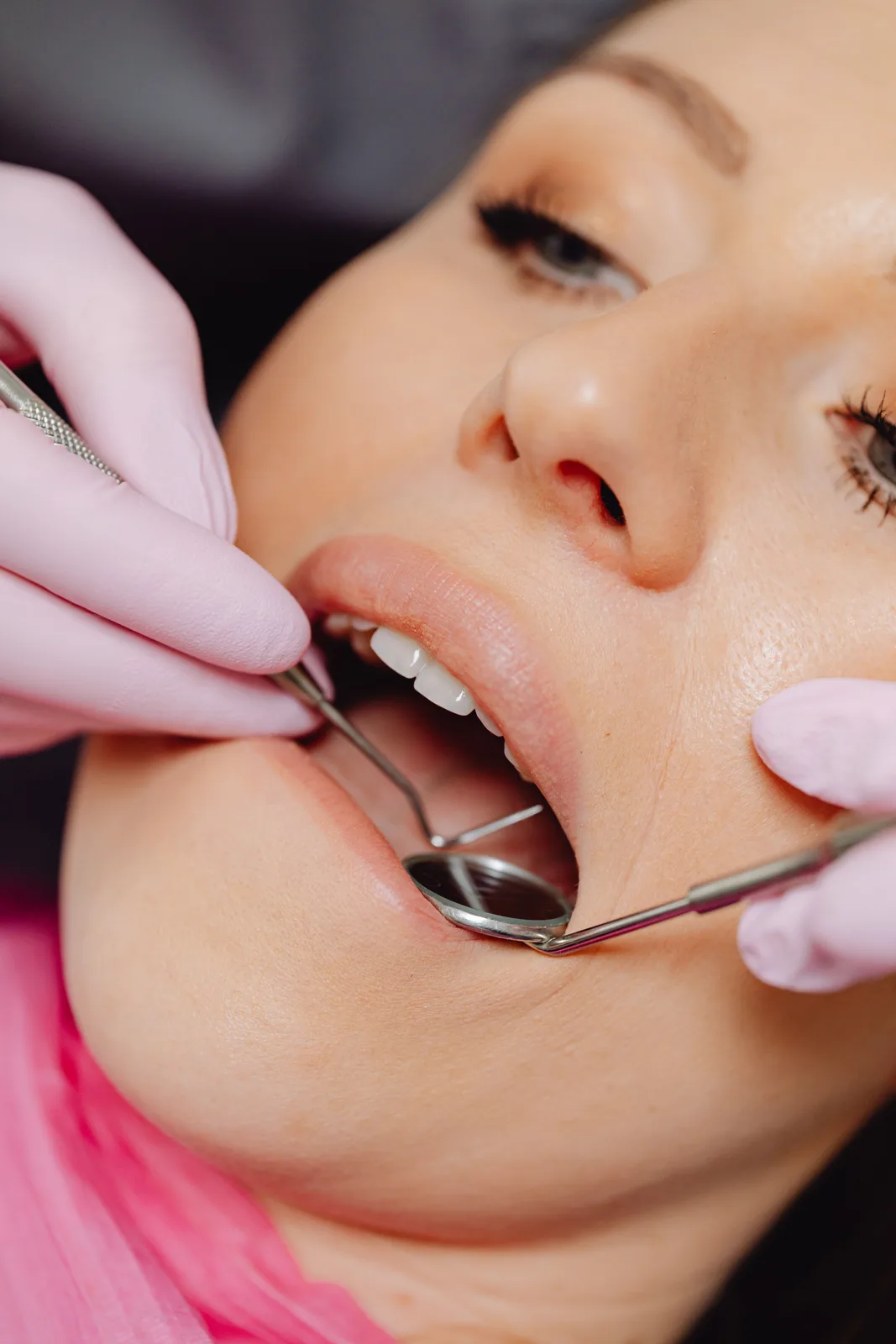 Mirror and probe exam of the lower arch, referred to in the Tooth Extraction Implant section for Victoria