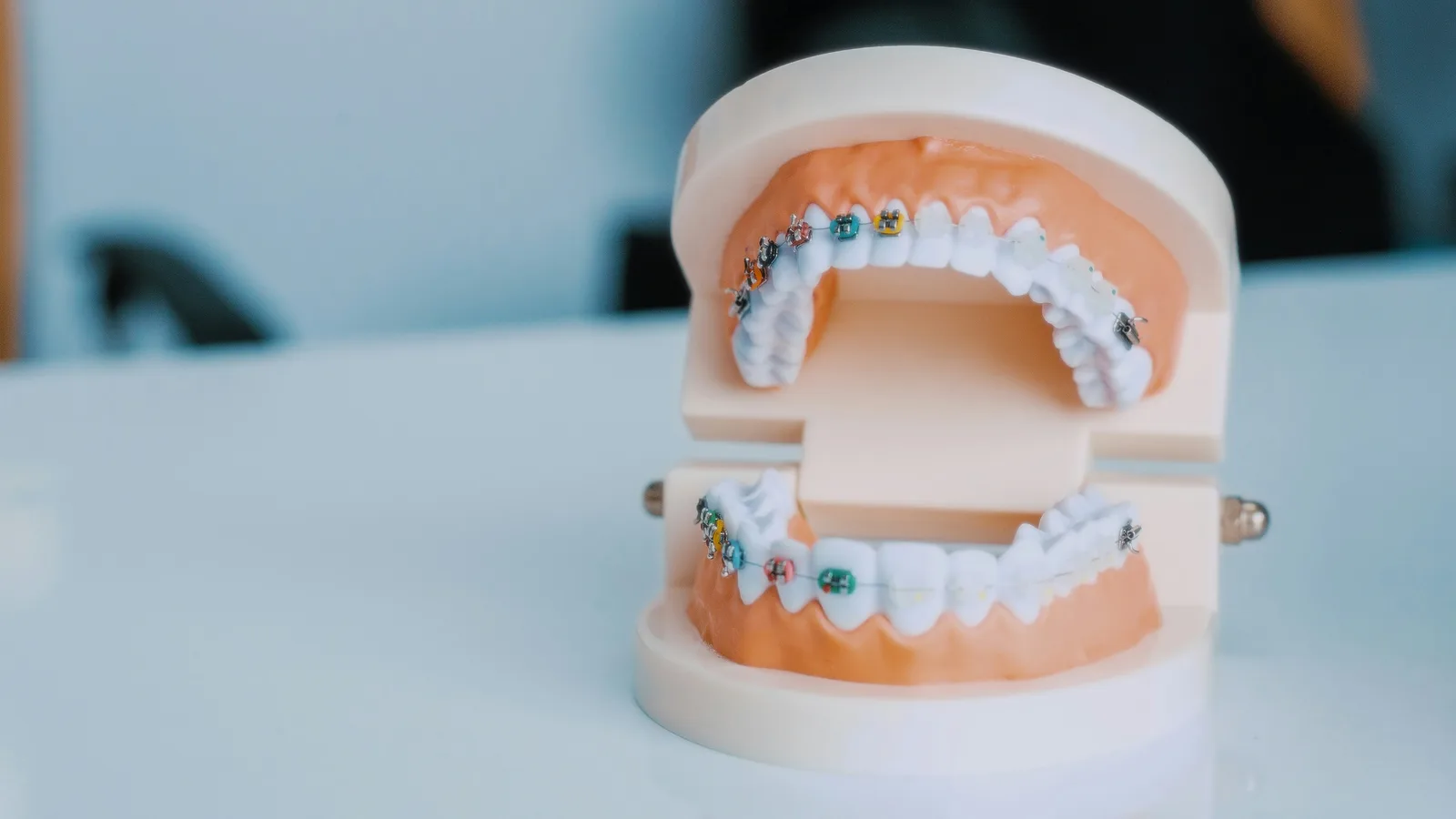Dental model of the upper and lower arch, alongside the Implant Crown explanation in Victoria