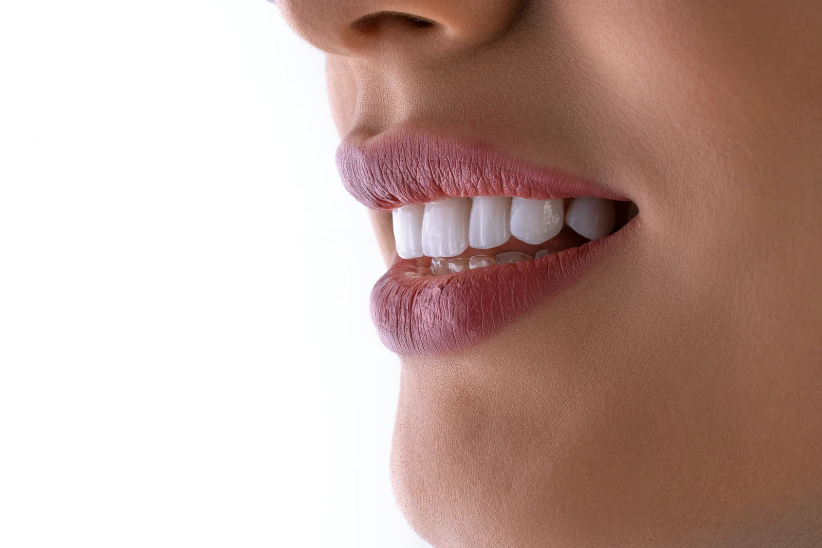 Patient profile smile after implant restoration, referred to in the Same Day Implants section for Victoria