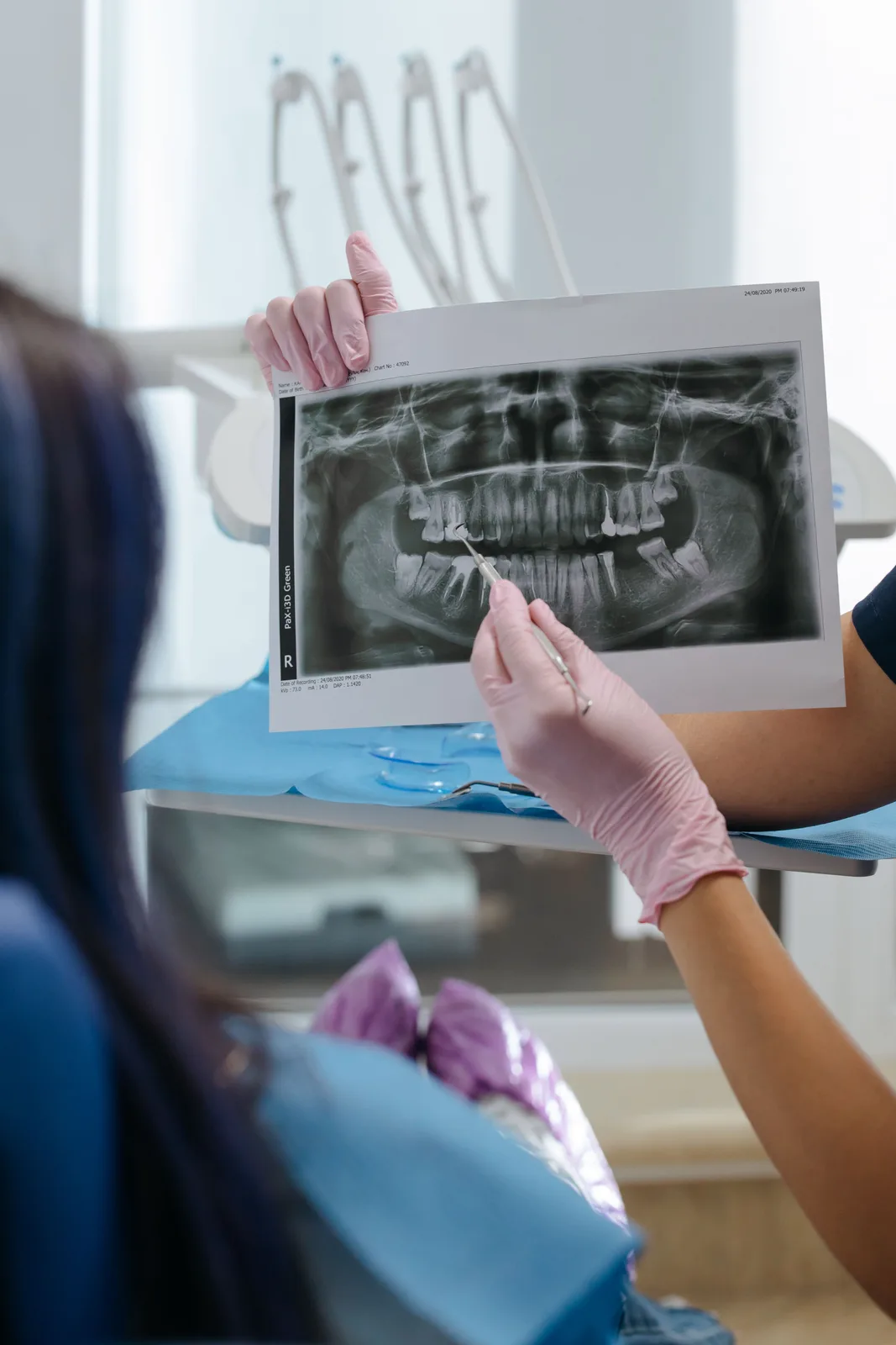 Reviewing a panoramic X-ray with a patient, shown while covering Dental Implants in Victoria