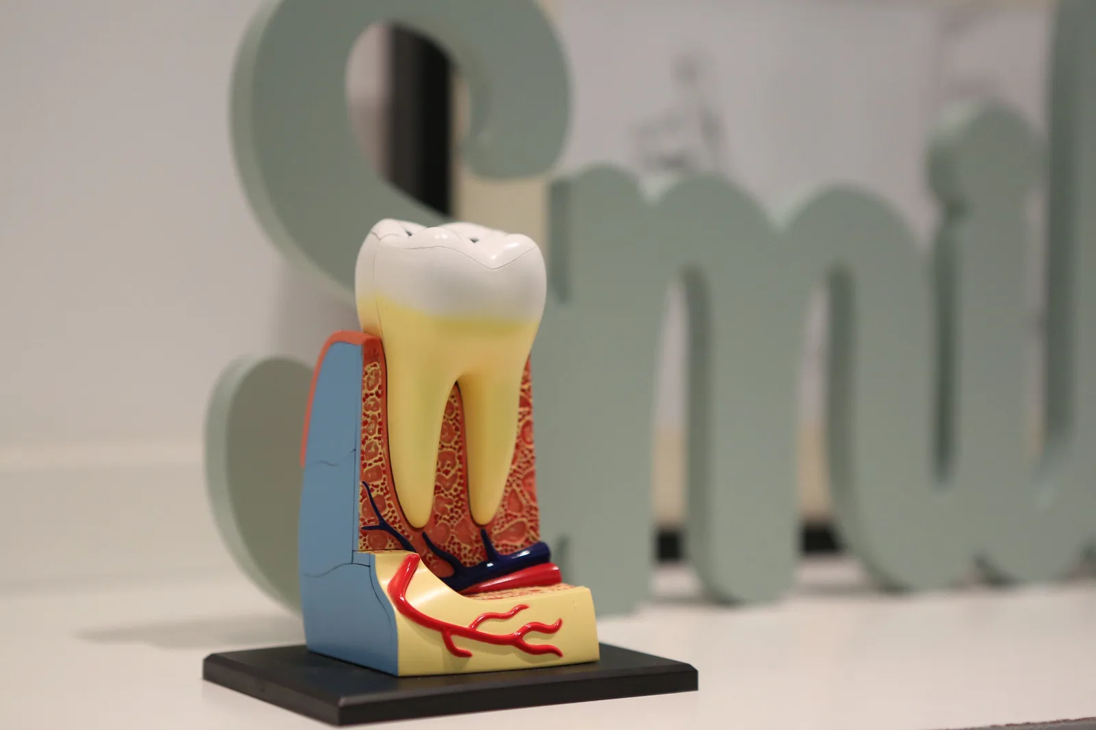 Tooth anatomy model showing the root below the gum, shown while covering Implant Cost in Victoria