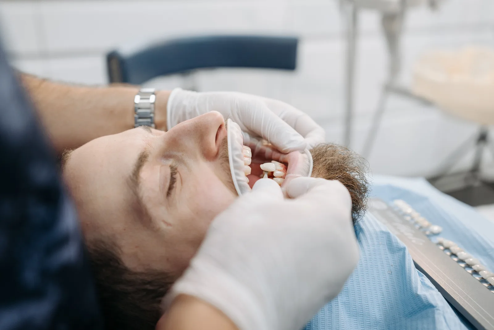 Trying in the shade for an implant crown, alongside the All-on-6 Implants explanation in Victoria