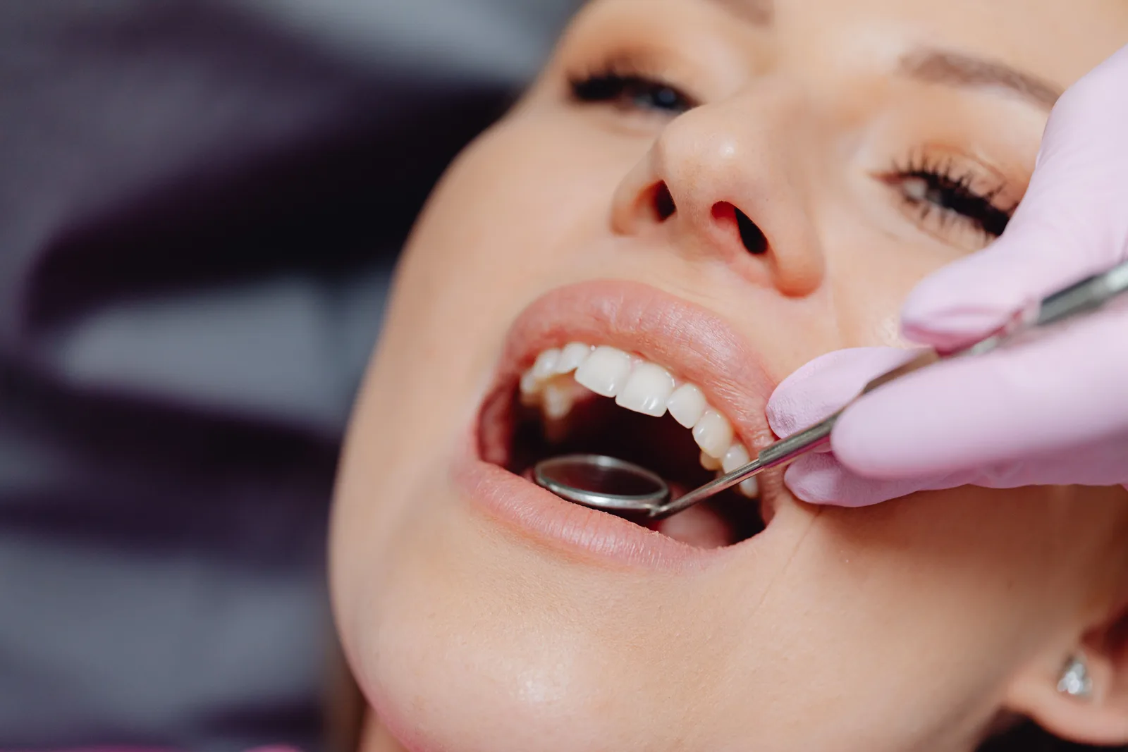 Upper arch exam with mirror and probe, shown while covering All-on-4 Implants in Victoria